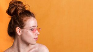 Comment différencier les taches de rousseur